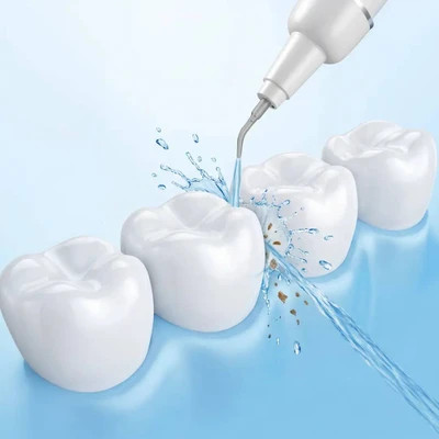 جرمگیر دندان گرین لاین مدلUltraSonic